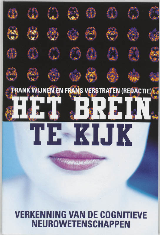 Brein Te Kijk