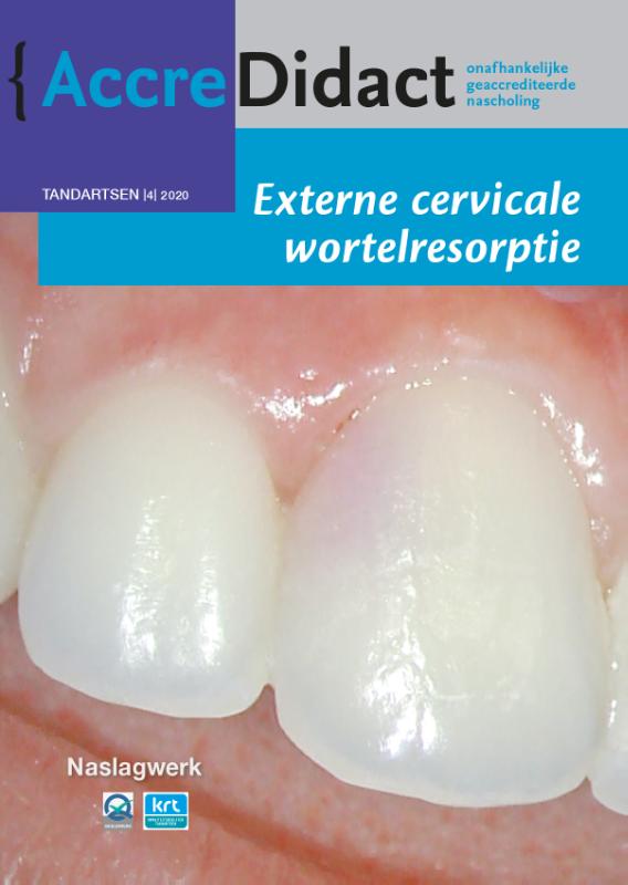 Externe cervicale wortelresorptie / AccreDidact / TA2020-4