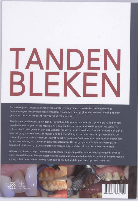 Tanden bleken achterkant