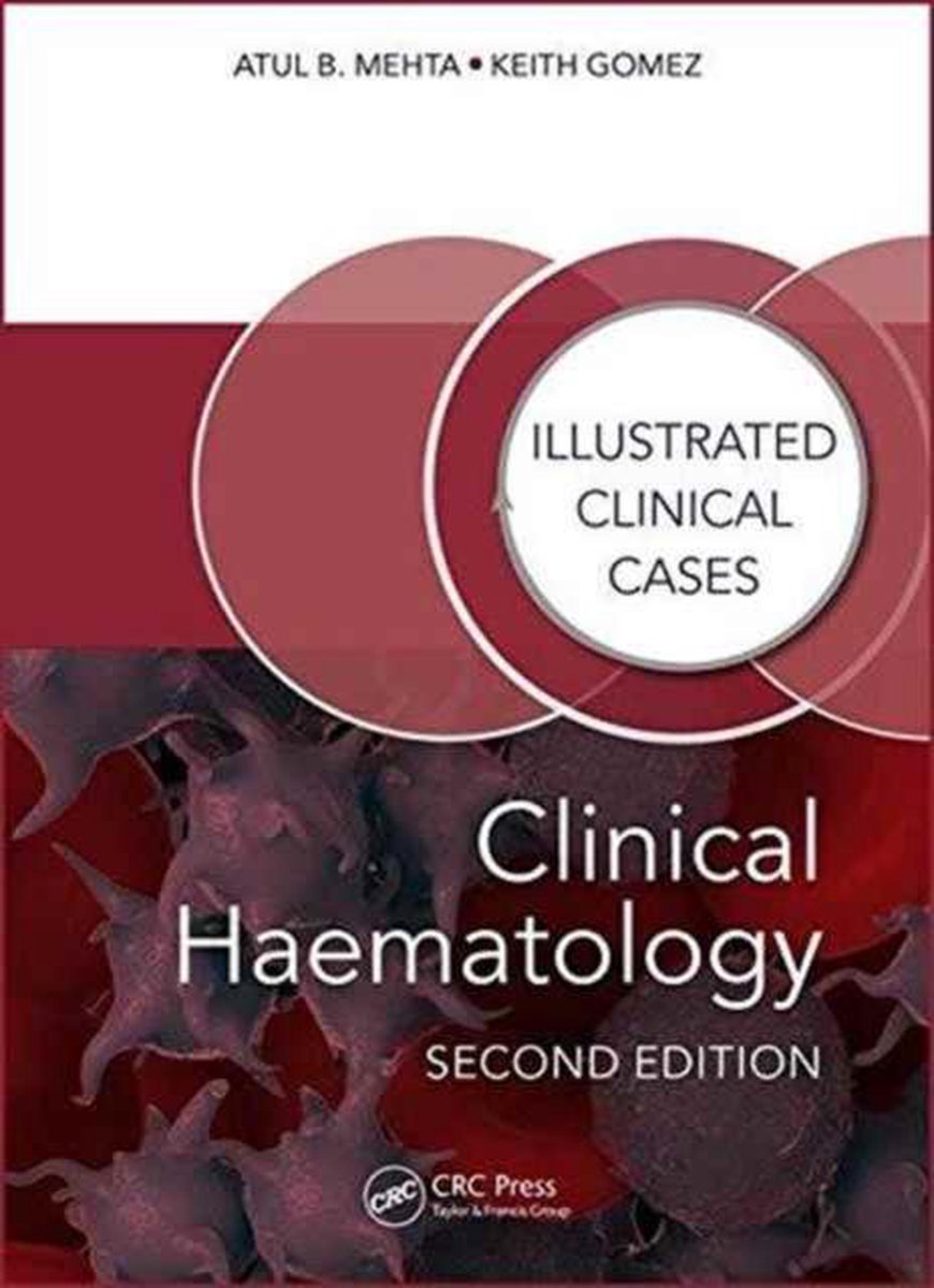 boekenbalie_9781482243796_cover Clinical Haematology