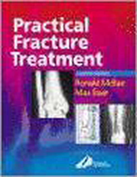 Practical Fracture Treatment