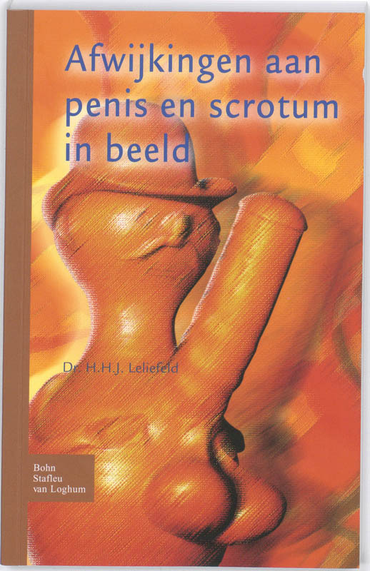 Leliefeld Afwijkingen Aan Penis En Scrotum In Beeld