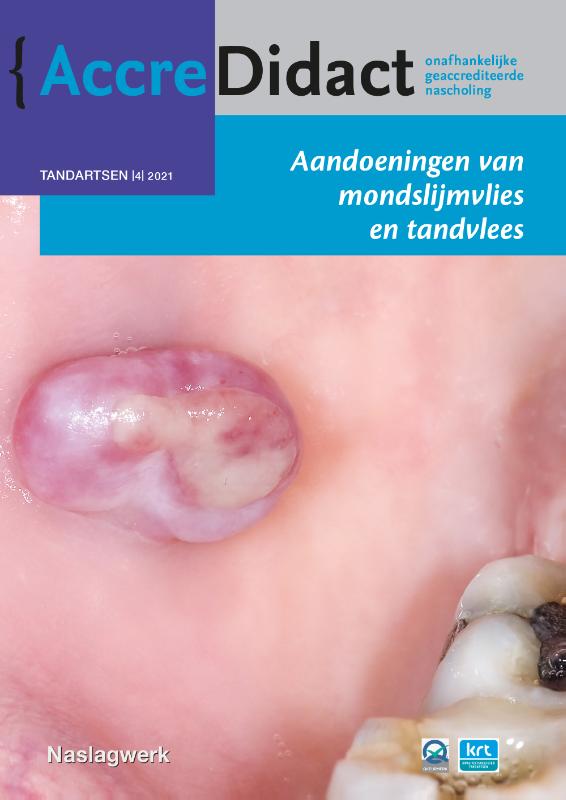 Aandoeningen van mondslijmvlies en tandvlees / AccreDidact / TA2021-4