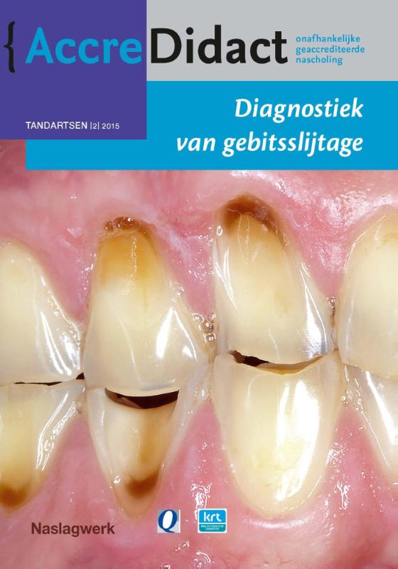 Diagnostiek van gebitsslijtage / AccreDidact / TA2015-2