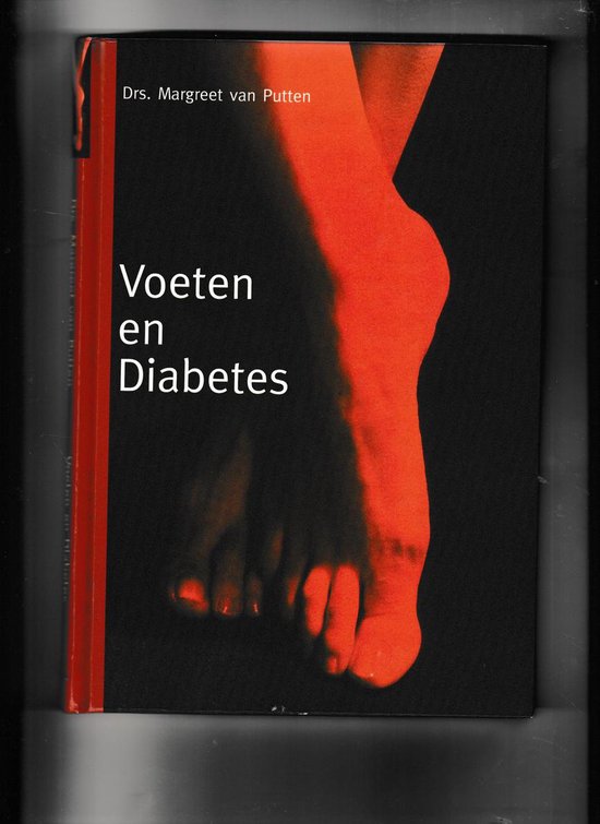 M.A. van Putten Voeten En Diabetes