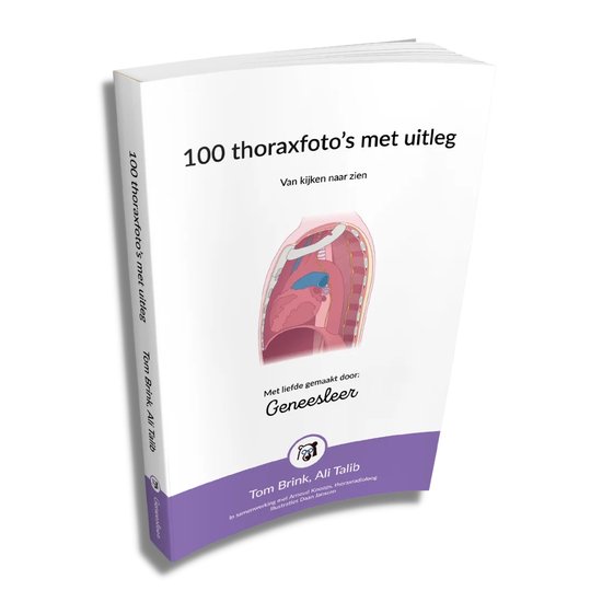 Geneesleer 100 Thoraxfoto's Met Uitleg - Van Kijken Naar Zien