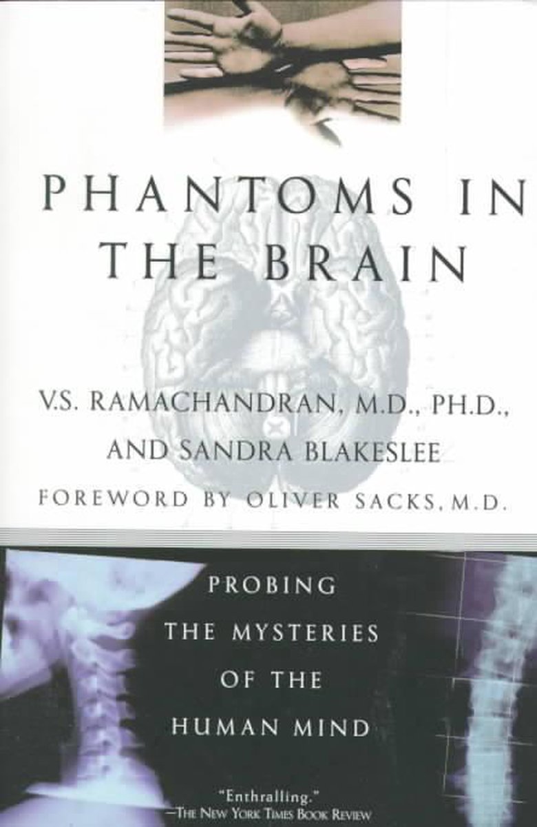 Phantoms in the Brain