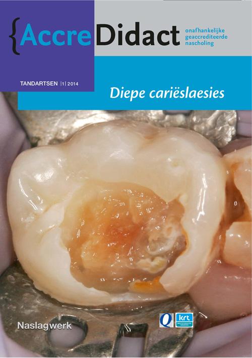 Diepe carieslaesies / AccreDidact / TA2014-1