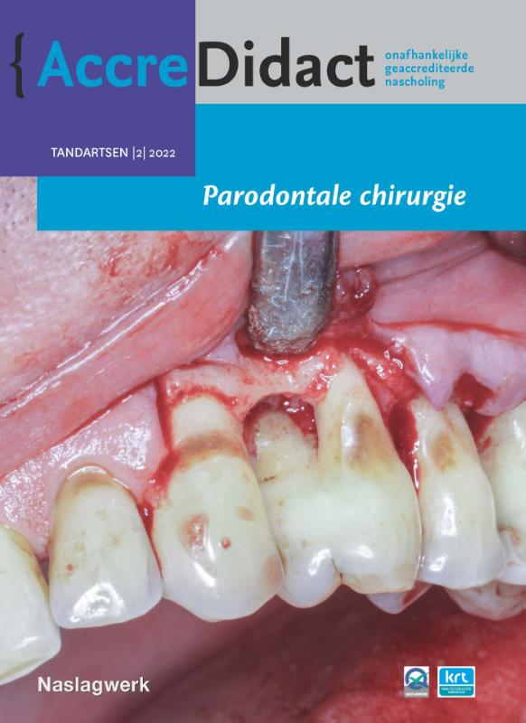 Parodontale chirurgie / AccreDidact / 2022/2