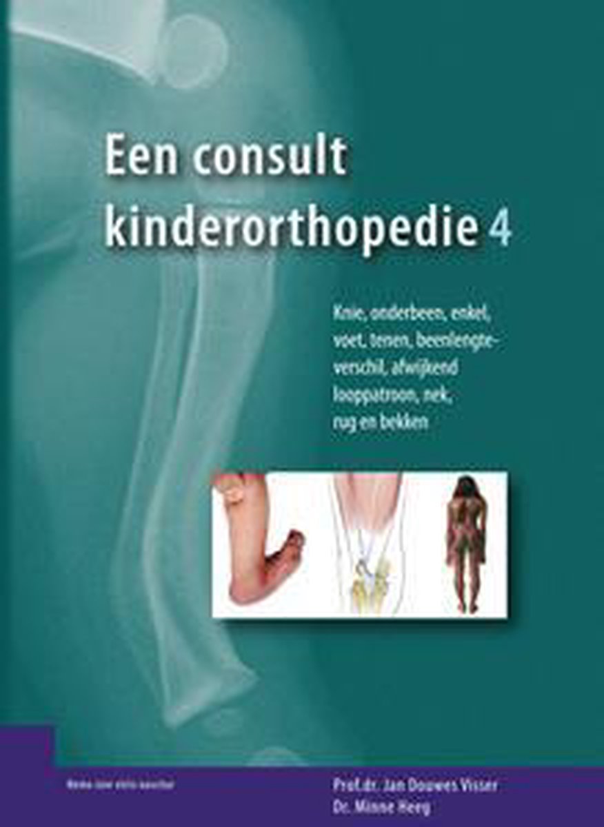 boekenbalie_9789080333000_cover Een consult kinderorthopedie, deel 4