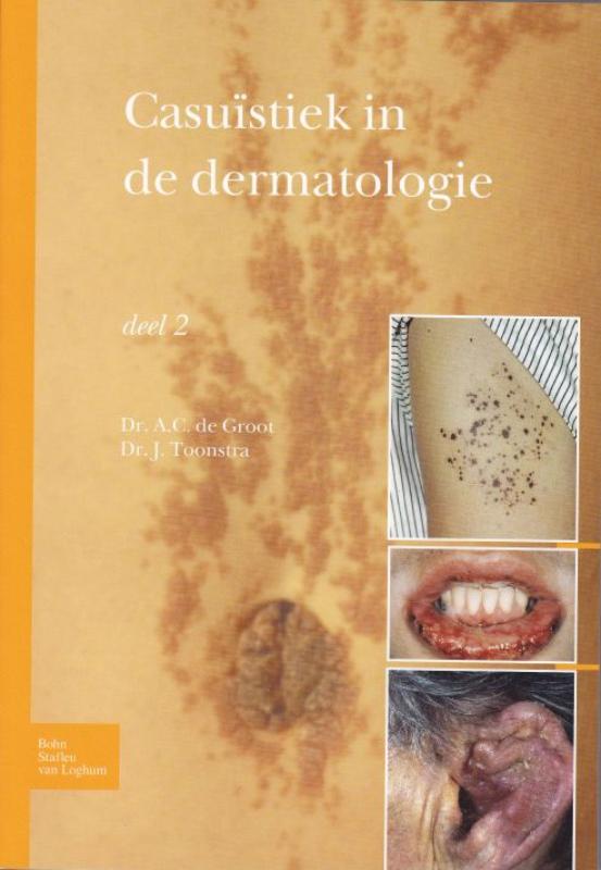 A.C. Groot Casuïstiek In De Dermatologie
