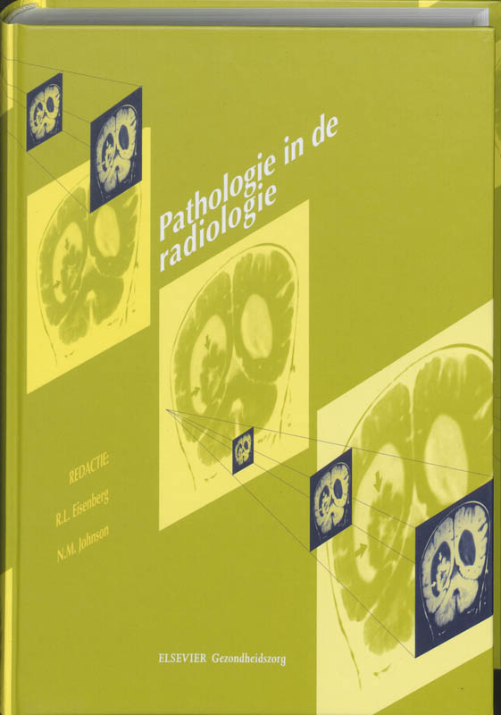 Leerboeken voor radiologisch laboranten  -   Pathologie in de Radiologie