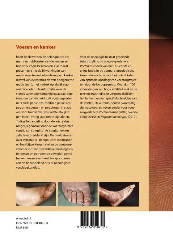 Voeten en kanker achterkant