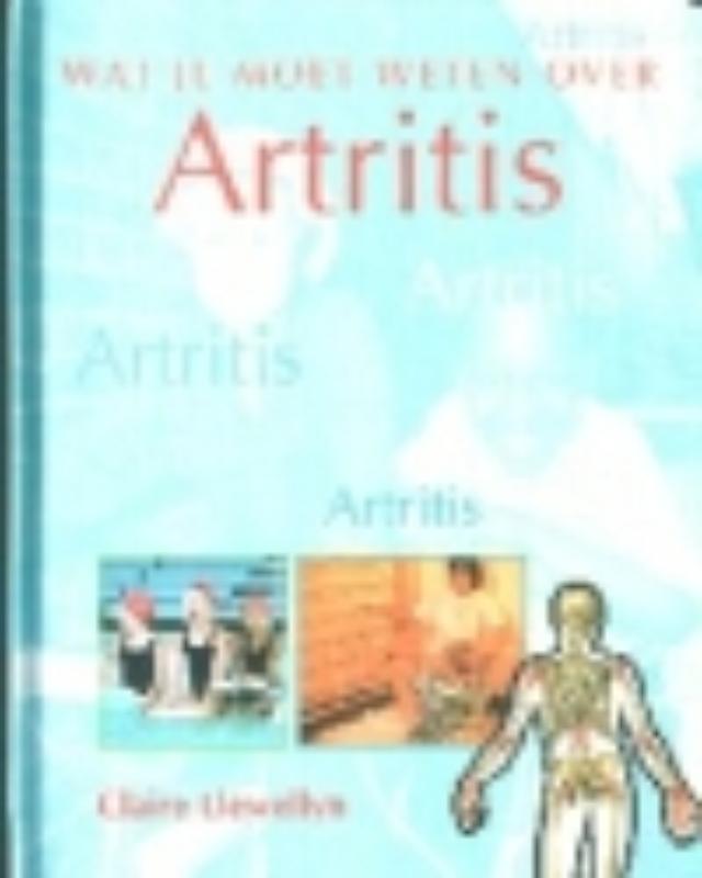 Artritis / Wat jij wilt weten over