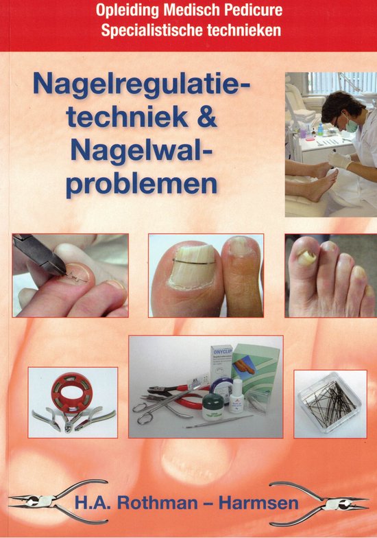 Nagelregulatietechniek en nagelwalproblemen