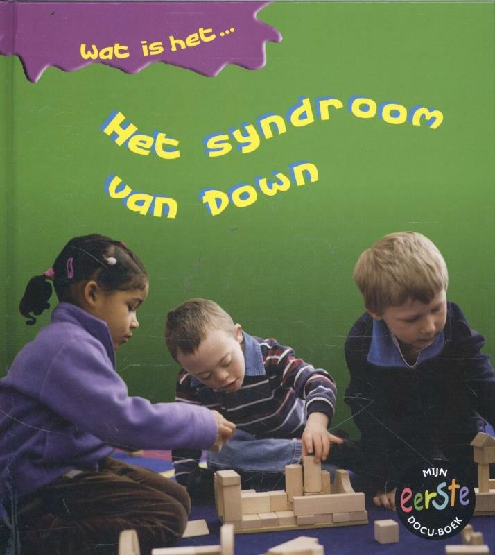 Het syndroom van Down / Wat is het...