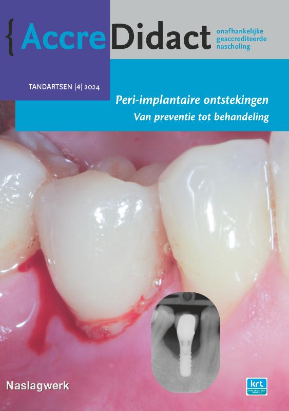 Peri-implantaire ontstekingen / AccreDidact / TA2024/4