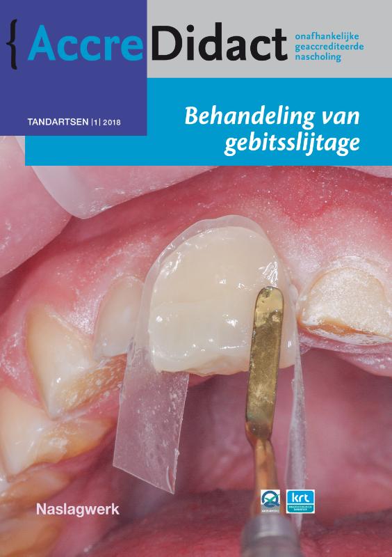 Behandeling van gebitsslijtage / AccreDidact / TA2018-1