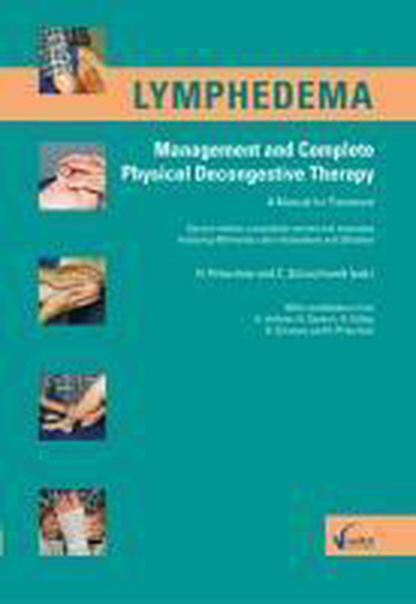 Lymphedema Management and Complete Physical Decongesitive Therapy