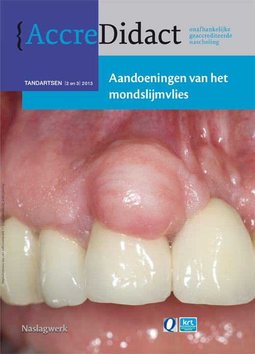 Aandoeningen van het mondslijmvlies / AccreDidact / TA2/3-2013