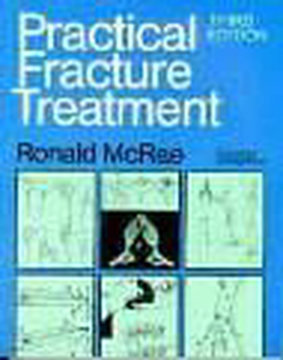 Practical Fracture Treatment