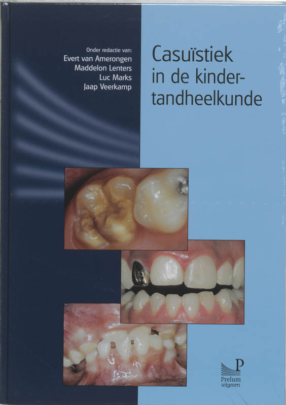 Casuistiek in de kindertandheelkunde 1