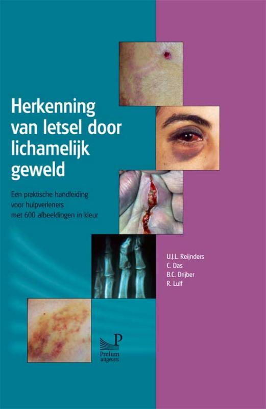 Udo Reijnders Herkenning Van Letsel Door Lichamelijk Geweld