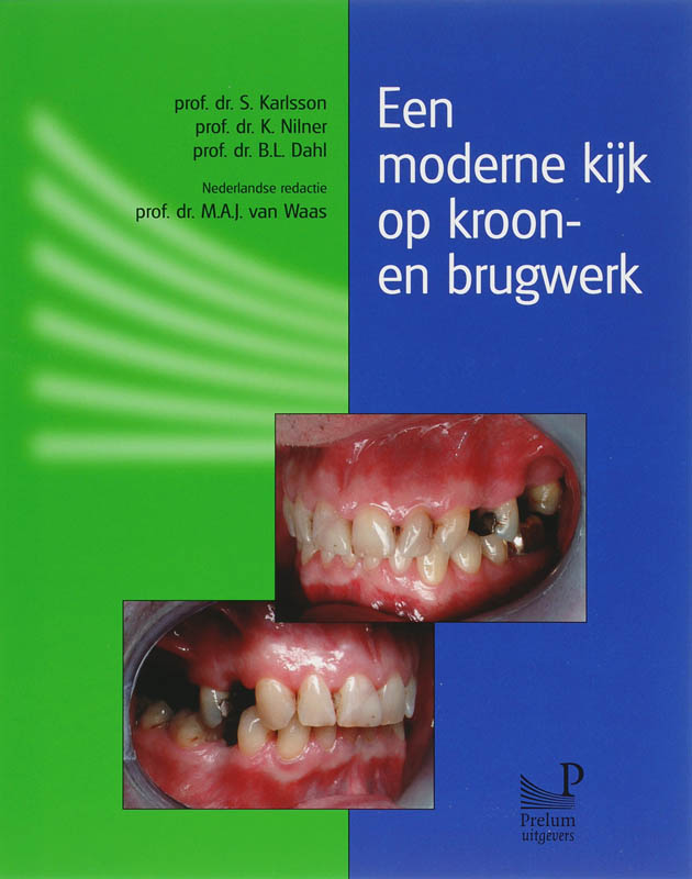 Een Moderne Kijk Op Kroon- En Brugwerk