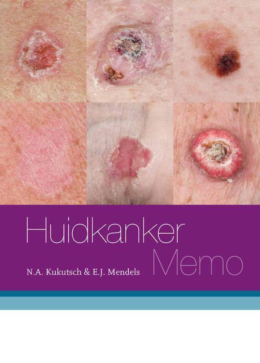 Huidkanker Memo