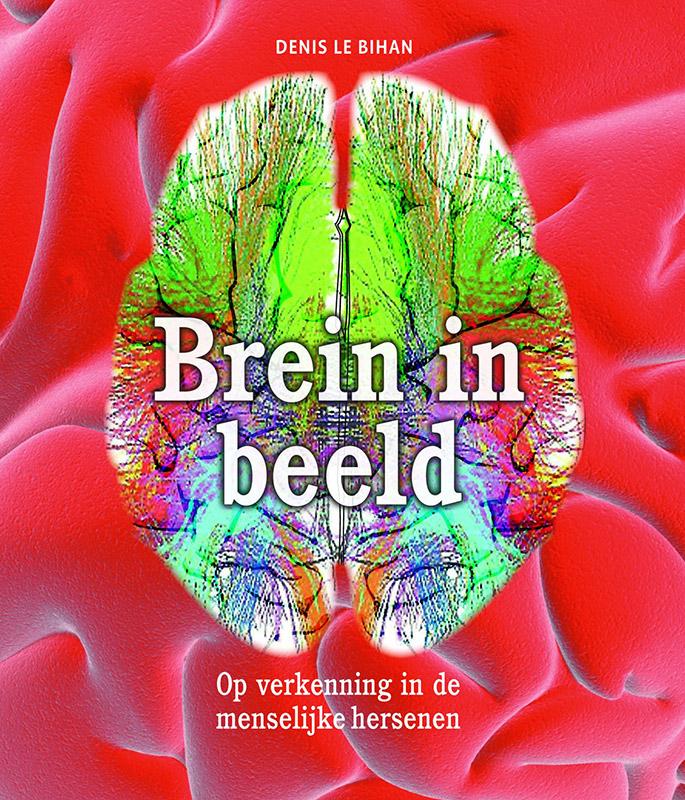 Brein in beeld