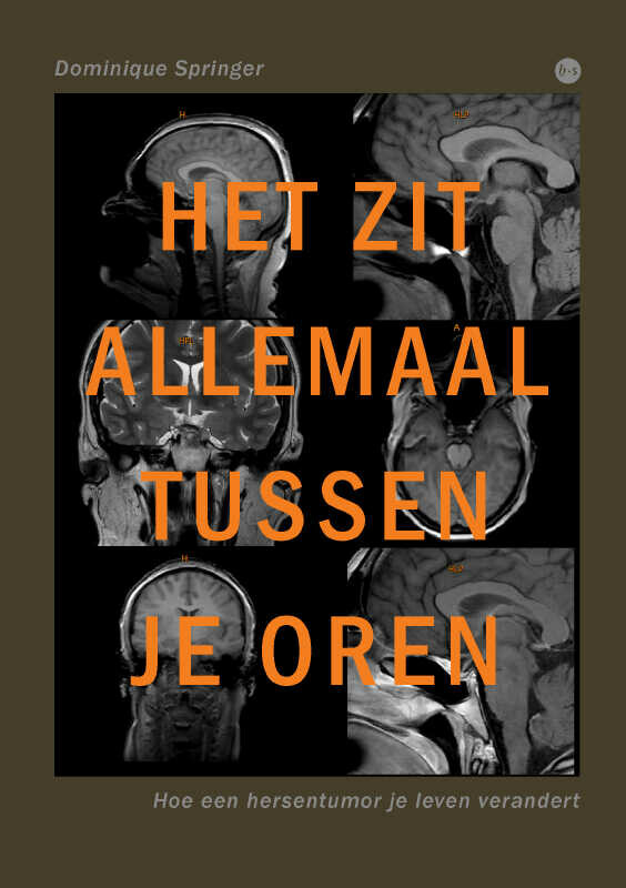 Het zit allemaal tussen je oren