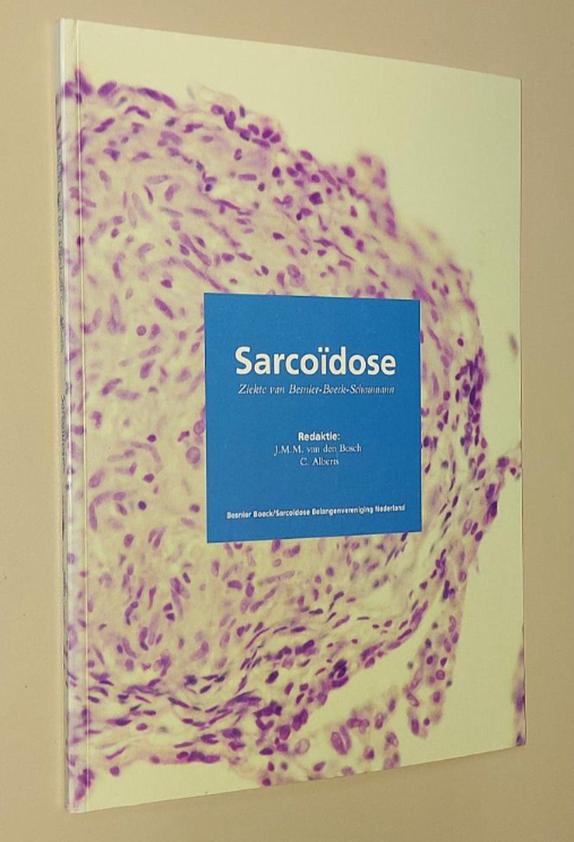 Sarcoidose