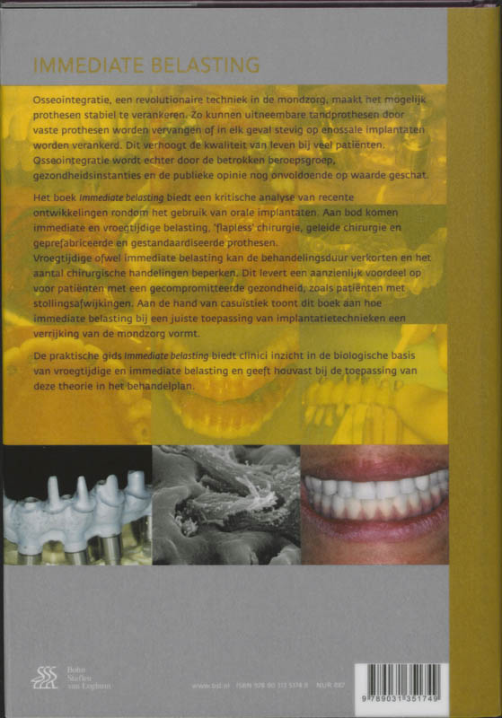 Immediate Belasting Van Orale Implantaten achterkant
