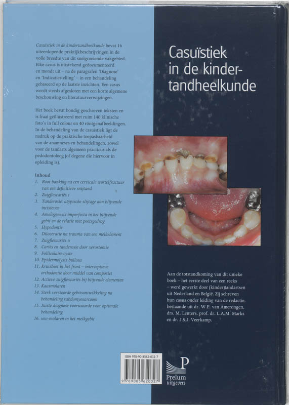Casuistiek in de kindertandheelkunde 1 achterkant