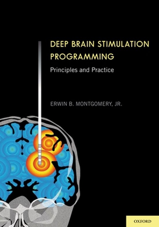 Deep Brain Stimulation Programming