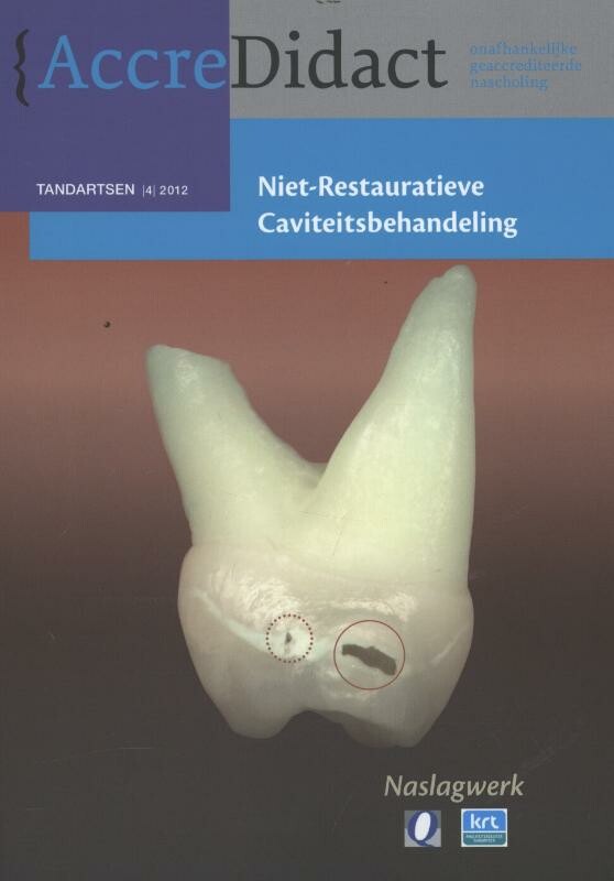 Niet-restauratieve caviteitsbehandeling / AccreDidact / TA2012-04