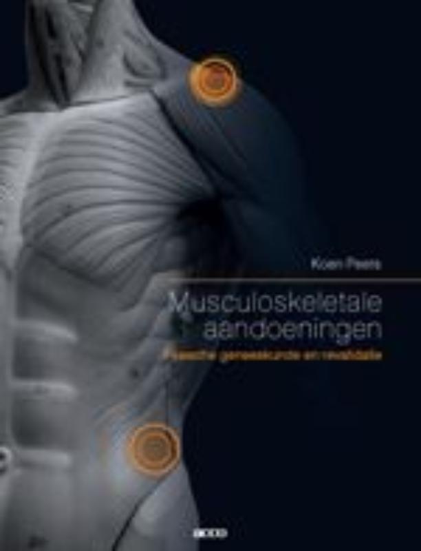 Musculoskeletale aandoeningen