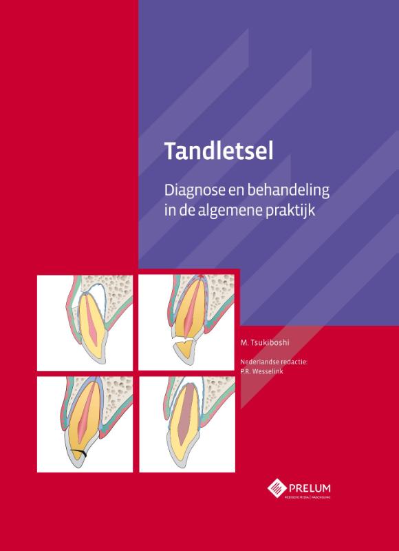 Tandletsel achterkant