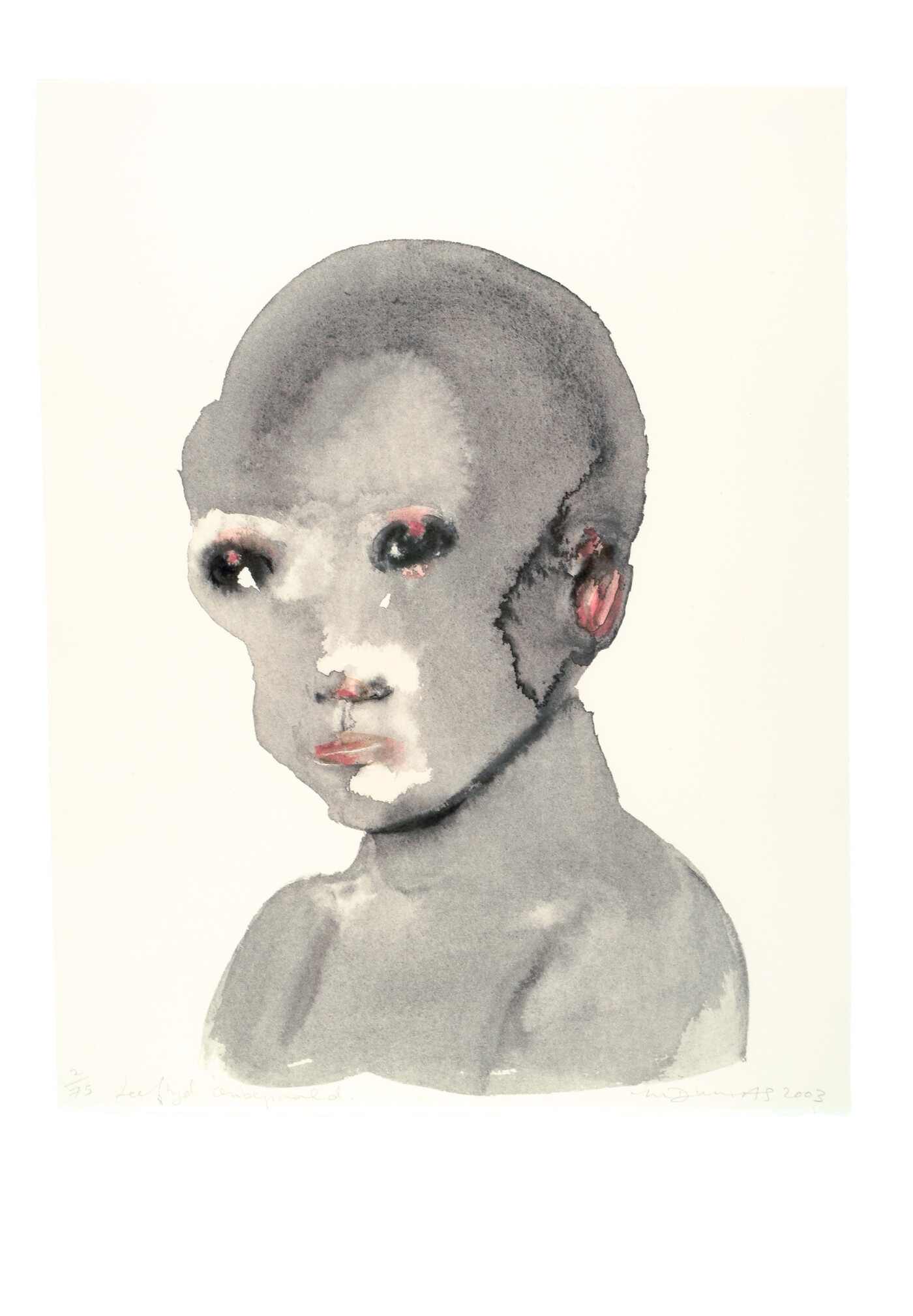 Waarom kunst in het ziekenhuis