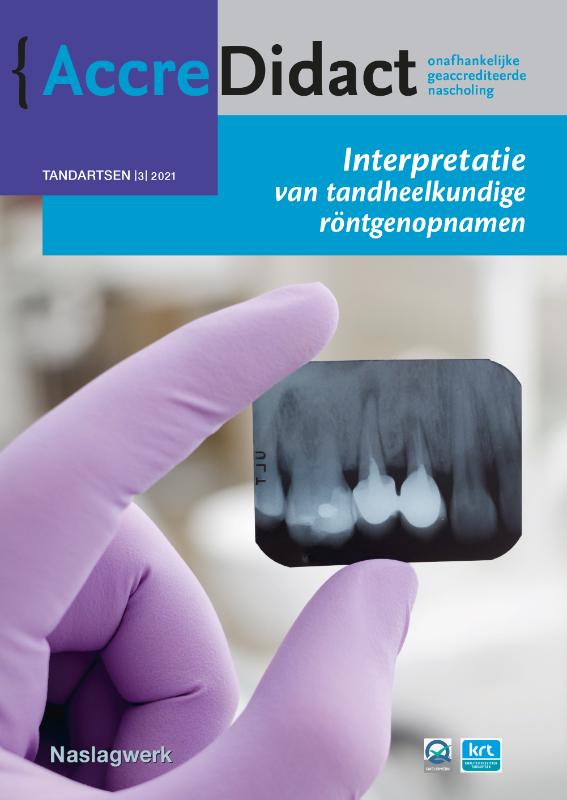 Interpretatie van tandheelkundige röntgenopnamen / AccreDidact / TA2021-3
