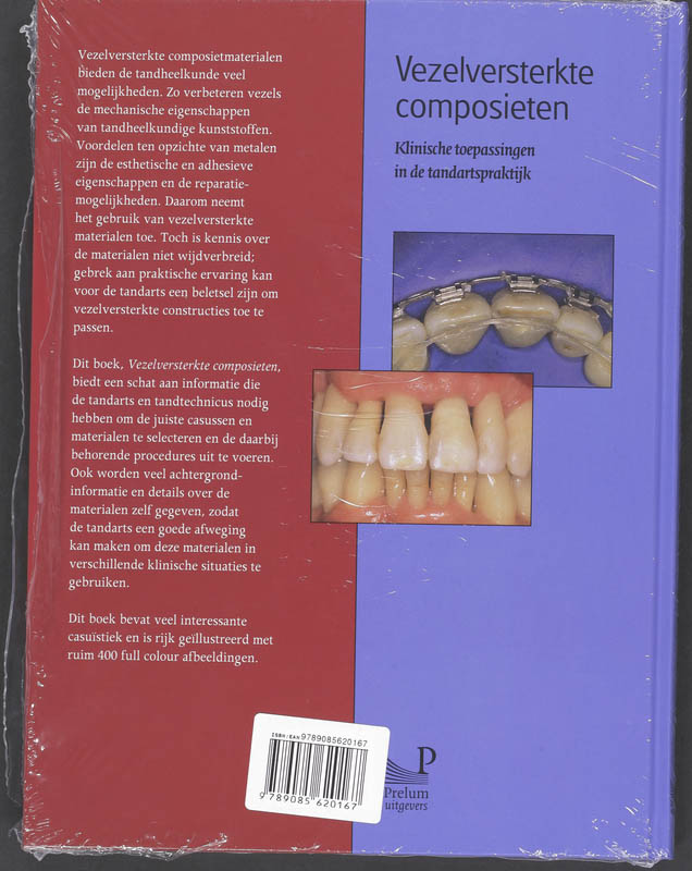 Vezelversterkte composieten achterkant