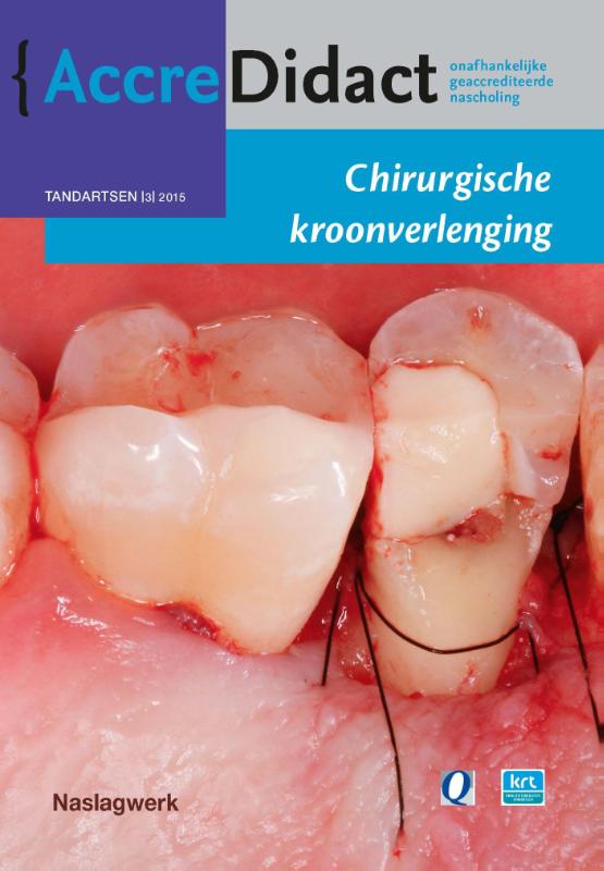 Chirurgische kroonverlenging / AccreDidact / TA2015-3