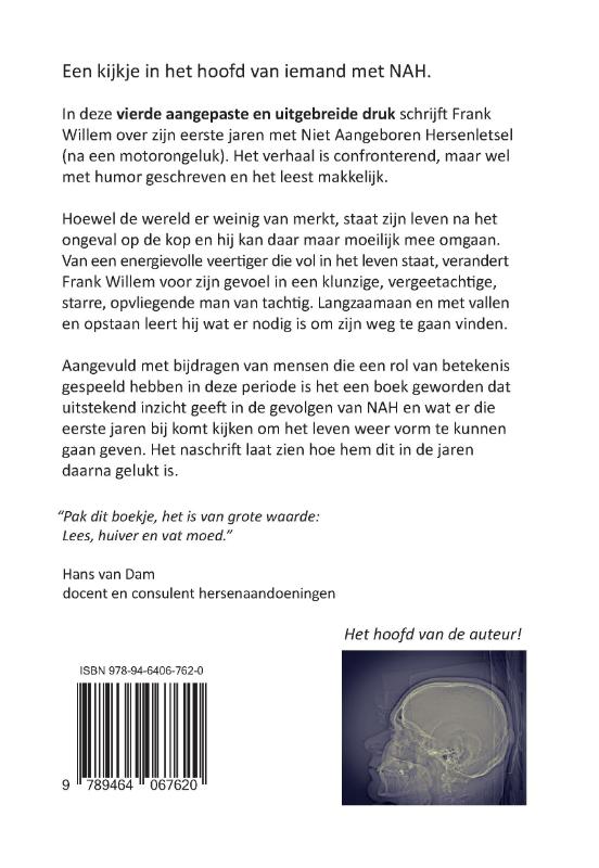 NAHgenoeg niets te zien achterkant